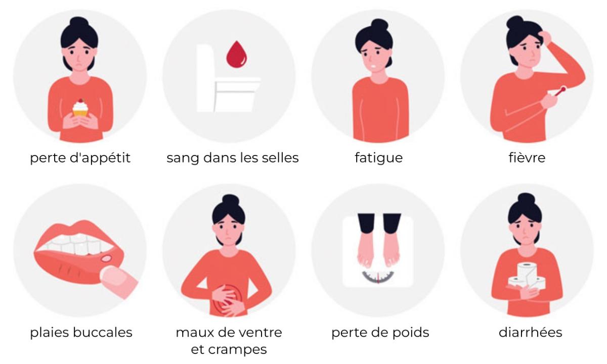 Symptomes de la maladie de Crohn
